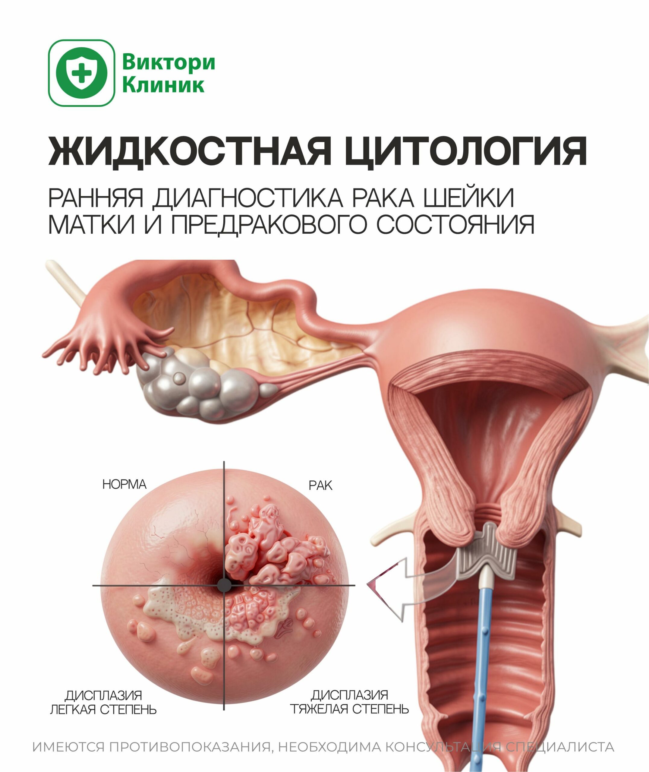 Жидкостная цитология