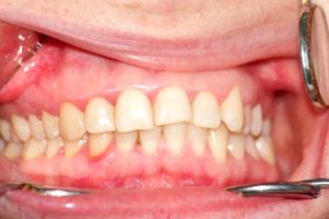 2-Kogda-neobhodima-konsultatciia-ortodonta