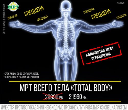 МРТ акция тотал боди
