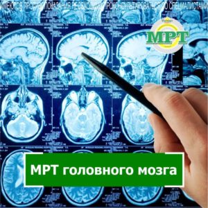 МРТ головного мозга в Victory Clinic