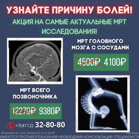 МРТ головного мозга с сосудами