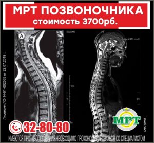 МРТ позвоночника от Victory Clinic